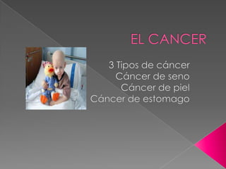 EL CANCER  3 Tipos de cáncer Cáncer de seno Cáncer de piel Cáncer de estomago  
