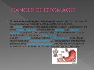 CANCER DE ESTOMAGOEl cáncer de estómago o cáncer gástrico es un tipo de crecimiento tisular maligno producido por la proliferación contigua de células anormales con capacidad de invasión y destrucción de otros tejidos y órganos, en particular el esófago y el intestino delgado, causando cerca de un millón de muertes en el mundo anualmente. En las formas metastásicas, las células tumorales pueden infiltrar los vasos linfáticos de los tejidos, diseminarse a los ganglios linfáticos y, sobrepasando esta barrera, penetrar en la circulación sanguínea, después de lo cual queda abierto virtualmente el camino a cualquier órgano del cuerpo.