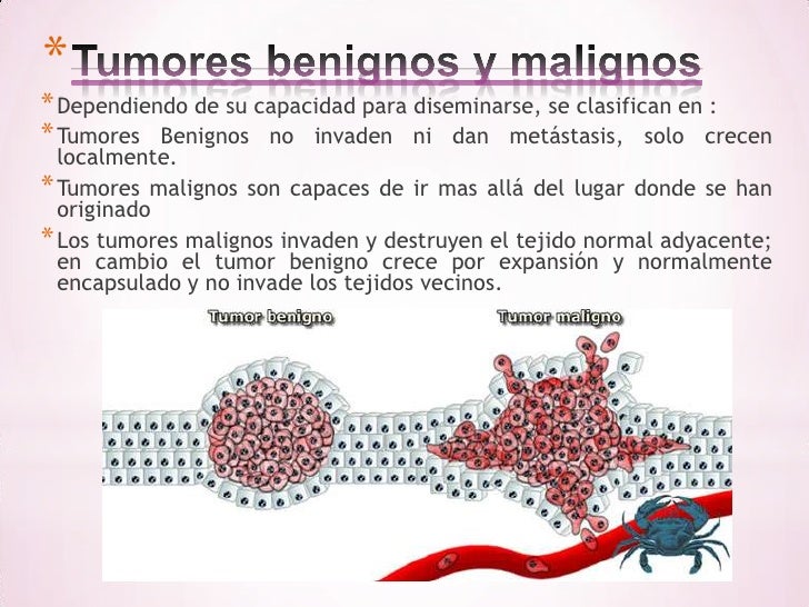 Diferença Entre Tumores Benignos E Malignos Cultura Notícias Diferença Entre Tumores Benignos E Malignos Cultura Notícias
