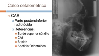 Calco cefalométrico

   CAE
     Parte posteroinferior
      radiolúcida
     Referencias:
       Borde   superior cóndilo
       CAI
       Basion
       Apofisis   Odontoides
 