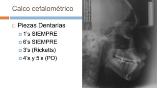 Calco cefalométrico

   Piezas Dentarias
     1’s SIEMPRE
     6’s SIEMPRE

     3’s (Ricketts)

     4’s y 5’s (PO)
 