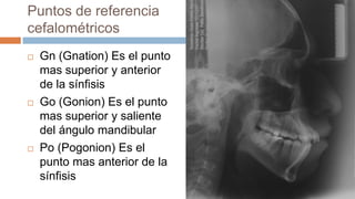 Puntos de referencia
cefalométricos
   Gn (Gnation) Es el punto
    mas superior y anterior
    de la sínfisis
   Go (Gonion) Es el punto
    mas superior y saliente
    del ángulo mandibular
   Po (Pogonion) Es el
    punto mas anterior de la
    sínfisis
 