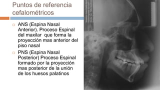Puntos de referencia
cefalométricos
   ANS (Espina Nasal
    Anterior). Proceso Espinal
    del maxilar que forma la
    proyección mas anterior del
    piso nasal
   PNS (Espina Nasal
    Posterior) Proceso Espinal
    formado por la proyección
    mas posterior de la unión
    de los huesos palatinos
 