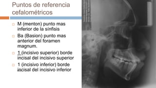 Puntos de referencia
cefalométricos
   M (menton) punto mas
    inferior de la sínfisis
   Ba (Basion) punto mas
    anterior del foramen
    magnum.
   1 (incisivo superior) borde
    incisal del incisivo superior
   1 (incisivo inferior) borde
    incisal del incisivo inferior
 