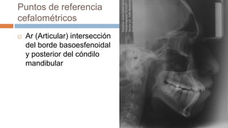 Puntos de referencia
cefalométricos
   Ar (Articular) intersección
    del borde basoesfenoidal
    y posterior del cóndilo
    mandibular
 