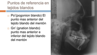 Puntos de referencia en
tejidos blandos
   Po’(pogonion blando) El
    punto mas anterior del
    tejido blando del mentón
   Gn’ (gnation blando)
    punto mas anterior e
    inferior del tejido blando
    del mentón
 