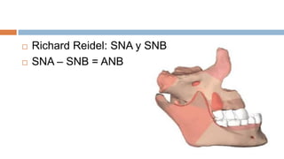    Richard Reidel: SNA y SNB
   SNA – SNB = ANB
 