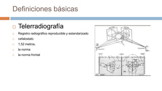 Definiciones básicas

   Telerradiografía
   Registro radiográfico reproducible y estandarizado
   cefalostato
   1,52 metros.
   la norma
   la norma frontal
 