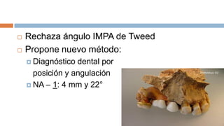    Rechaza ángulo IMPA de Tweed
   Propone nuevo método:
     Diagnóstico dental por
      posición y angulación
     NA – 1: 4 mm y 22°
 