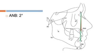    ANB: 2°
 