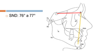    SND: 76° a 77°
 