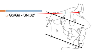    Go/Gn - SN:32°
 