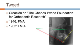 Tweed
   Creación de “The Charles Tweed Foundation
    for Orthodontic Research”
   1946: FMA
   1953: FMIA
 