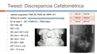 Tweed: Discrepancia Cefalométrica
                                                   1   FMA=25°   FMIA=68°
   valores angulares: FMA 29, FMIA 50, IMPA 101
   Aplicar el cuadro:                             2   FMA≥30°   FMIA=65°

   En el caso 1 : DC°=FMIA Px – FMIA ideal        3   FMA≤20°   IMPA=92°

   DC°=50– 68
   DC°=-18
   DC mm= DC°x 0.8
   DC mm= -18°x 0.8
   DC mm= -14.4
   DT=DC + DM
   DT=-14.4 + (-3)
   DT= -17.4 mm
 