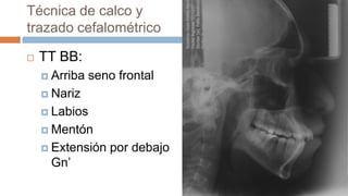 Técnica de calco y
trazado cefalométrico

   TT BB:
     Arriba   seno frontal
     Nariz

     Labios

     Mentón

     Extensión   por debajo
     Gn’
 