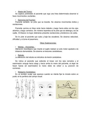 • Ataxia del Tronco:
Se explora pidiéndole al paciente que siga una linea determinada observar si
hace movimientos oscilantes.
• Ejercicios de Fournier:
Paciente sentado, se pide que se levante. Se observa movimientos lentos y
oscilaciones.
Paciente camina en línea recta hacia delante y luego hacia atrás con los ojos
abiertos y luego cerrados. De manera repentina se le pide que se detenga y se de
vuelta. El Ataxico no logra detenerse presenta oscilaciones y tendencia a la caída.
Se le pide al paciente que suba y baje las escaleras. Se observa velocidad,
dificultad y si toma el pasamano.
Otras Exploraciones:
• Metrías - Dismetrías :
Alteración neurológica que impide al sujeto realizar un acto motor ajustado a la
distancia demandada. Se observa en lesiones cerebelosas.
• Rebote:
La alteración del rebote es indicativo de lesión cerebelosa.
Se indica al paciente que extienda el brazo con los ojos cerrados y el
examinador empuja hacia abajo y hacia arriba la mano del paciente, al dejar de
hacer fuerza (el examinador) la mano debe de volver a su posición de
comienzo.
• Nistagmo Cerebeloso:
Es un temblor ocular que aparece cuando se intenta fijar la mirada sobre un
punto en la periferia del campo visual.
 
