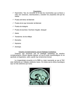 Diagnóstico:
 Hipermetria: Tipo de dismetría en la que los movimientos que se llevan a
cabo son excesivos, desmesurados y exceden los propósitos del que los
realiza.
 Prueba del índice de Babinski
 Prueba de la raya horizontal de Babinski
 Prueba de nistagmo
 Prueba de escritura: Escritura irregular, desigual
 Ataxia
 Transtornos de los reflejos
 Dismetria
 Hipotonia
 Asinergia
Estudios Complementarios para la Patología Cerebelosa:
Tenemos que reconocer que en patología cerebelosa los estudios
complementarios ofrecen algunas lagunas, ya que la parte neurofisiológica no es
aportante al diagnóstico, salvo cuando hay compromiso troncal.
La imagenología encuentra en la RMN su mejor exponente ya que el TAC
esta interferida por múltiples artefactos óseos. Sin dudas que la clínica neurológica
aquí es más soberana que nunca.
 