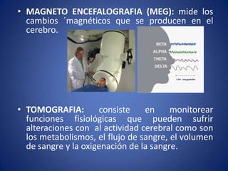 • MAGNETO ENCEFALOGRAFIA (MEG): mide los
cambios ´magnéticos que se producen en el
cerebro.

• TOMOGRAFIA:
consiste
en
monitorear
funciones fisiológicas que pueden sufrir
alteraciones con al actividad cerebral como son
los metabolismos, el flujo de sangre, el volumen
de sangre y la oxigenación de la sangre.

 