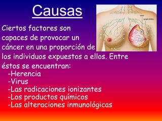Causas
Ciertos factores son
capaces de provocar un
cáncer en una proporción de
los individuos expuestos a ellos. Entre
éstos se encuentran:
  -Herencia
  -Virus
  -Las radicaciones ionizantes
  -Los productos químicos
  -Las alteraciones inmunológicas
 