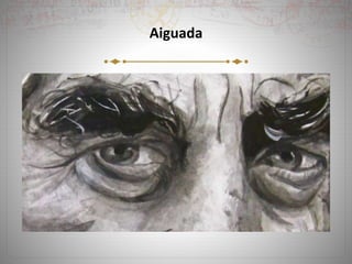 Aiguada
 