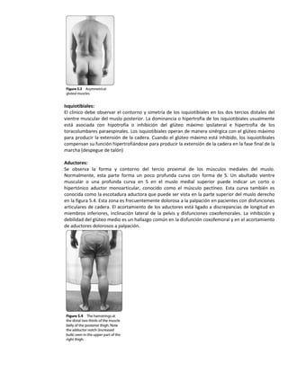 Isquiotibiales: 
El clínico debe observar el contorno y simetría de los isquiotibiales en los dos tercios distales del vientre muscular del muslo posterior. La dominancia o hipertrofia de los isquiotibiales usualmente está asociada con hipotrofia o inhibición del glúteo máximo ipsilateral e hipertrofia de los toracolumbares paraespinales. Los isquiotibiales operan de manera sinérgica con el glúteo máximo para producir la extensión de la cadera. Cuando el glúteo máximo está inhibido, los isquiotibiales compensan su función hipertrofiándose para producir la extensión de la cadera en la fase final de la marcha (despegue de talón) 
Aductores: 
Se observa la forma y contorno del tercio proximal de los músculos mediales del muslo. Normalmente, esta parte forma un poco profunda curva con forma de S. Un abultado vientre muscular o una profunda curva en S en el muslo medial superior puede indicar un corto o hipertónico aductor monoarticular, conocido como el músculo pectíneo. Esta curva también es conocida como la escotadura aductora que puede ser vista en la parte superior del muslo derecho en la figura 5.4. Esta zona es frecuentemente dolorosa a la palpación en pacientes con disfunciones articulares de cadera. El acortamiento de los aductores está ligado a discrepancias de longitud en miembros inferiores, inclinación lateral de la pelvis y disfunciones coxofemorales. La inhibición y debilidad del glúteo medio es un hallazgo común en la disfunción coxofemoral y en el acortamiento de aductores dolorosos a palpación. 
 