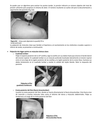 Se puede usar un algoritmo para evaluar los puntos tender, la presión indicaría un número objetivo del nivel de presión suficiente para propiciar el síntoma de dolor. El número resultante se vuelve útil para la documentación y seguimiento del paciente (Fig. 8.6) 
La palpación de músculos clave que tienden al hipertono y el acortamiento en los síndromes cruzados superior e inferior de Janda, se presentan a continuación. 
Palpación de trigger points en músculos tónicos clave: 
o Cuadrado lumbar: 
Palpe el aspecto posterior de la 12ª costilla y siga la costilla con sus dedos hasta que alcance el borde lateral del erector espinal. El cuadrado lumbar es un músculo profundo localizado lateralmente al erector espinal entre el arco bajo de la región posterior de las costillas y la región posterior de la cresta ilíaca. Sumerja sus dedos lentamente en el cuadrado lumbar y evalúe la calidad del tejido blando. Note la respuesta del paciente 
o Cresta posterior del ílion (fascia tóracolumbar): 
Localice la cresta posterior del ílion, donde se inserta directamente la fascia tóracolumbar. Esta fascia sirve de inserción a muchos músculos tales como el latísimo del dorso y músculos abdominales. Palpe su tenderness a lo largo de la cresta posterior del ílion  