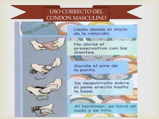 USO CORRECTO DEL 
CONDON MASCULINO 
 