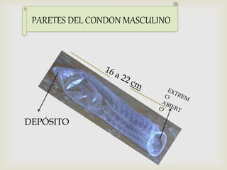 PARETES DEL CONDON MASCULINO 
DEPÓSITO 
 