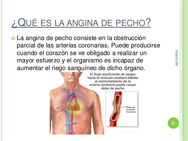 El precio en implanty al pecho