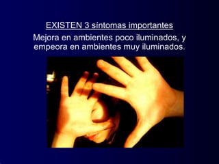 EXISTEN 3 síntomas importantes
Mejora en ambientes poco iluminados, y
empeora en ambientes muy iluminados.
 