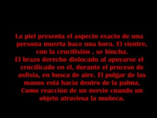 La piel presenta el aspecto exacto de una persona muerta hace una hora. El vientre, con la crucifixión , se hincha. El brazo derecho dislocado al apoyarse el crucificado en él, durante el proceso de asfixia, en busca de aire. El pulgar de las manos está hacia dentro de la palma. Como reacción de un nervio cuando un objeto atraviesa la muñeca. 