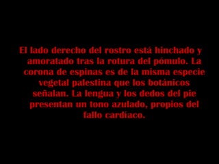 El lado derecho del rostro está hinchado y amoratado tras la rotura del pómulo. La corona de espinas es de la misma especie vegetal palestina que los botánicos señalan. La lengua y los dedos del pie presentan un tono azulado, propios del fallo cardíaco. 