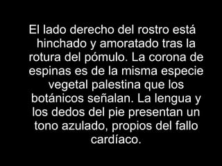 El lado derecho del rostro está hinchado y amoratado tras la rotura del pómulo. La corona de espinas es de la misma especie vegetal palestina que los botánicos señalan. La lengua y los dedos del pie presentan un tono azulado, propios del fallo cardíaco. 
