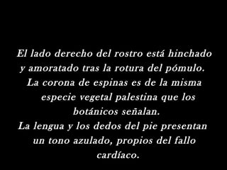El lado derecho del rostro está hinchado
y amoratado tras la rotura del pómulo.
  La corona de espinas es de la misma
     especie vegetal palestina que los
            botánicos señalan.
La lengua y los dedos del pie presentan
    un tono azulado, propios del fallo
                 cardíaco.
 