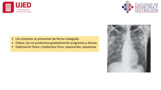 • Los síntomas se presentan de forma subaguda
• Fiebre, tos no productiva gradualmente progresiva y disnea.
• Exploracion fisica: crepitantes finos, taquicardia, taquipnea
 