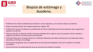 • Proliferación de células endoteliales (anormales) en vasos sanguíneos, con invasión a tejidos circundantes.
• Etapas avanzadas afectan otros órganos (pulmones, hígado, TGI)
• Proliferación vascular: Se observa una proliferación de células endoteliales que forman pequeños vasos sanguíneos o
capilares en la dermis.
• Células tumorales: Se observan células tumorales alrededor de los capilares, que son pequeñas células redondas y
angulares que tienen un núcleo oscuro y prominentes.
• Infiltrado inflamatorio: Se puede observar un infiltrado inflamatorio de células inflamatorias, principalmente células
plasmáticas, linfocitos y macrófagos.
• Extravasación de glóbulos rojos: Se puede observar extravasación de glóbulos rojos de los capilares en el tejido
circundante.
• Focos de necrosis: Se puede observar focos de necrosis en los nódulos tumorales.
Biopsia de estómago y
duodeno.
 