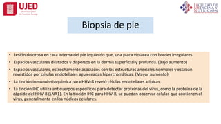 Biopsia de pie
• Lesión dolorosa en cara interna del pie izquierdo que, una placa violácea con bordes irregulares.
• Espacios vasculares dilatados y dispersos en la dermis superficial y profunda. (Bajo aumento)
• Espacios vasculares, estrechamente asociados con las estructuras anexiales normales y estaban
revestidos por células endoteliales agujereadas hipercromáticas. (Mayor aumento)
• La tinción inmunohistoquímica para HHV-8 reveló células endoteliales atípicas.
• La tinción IHC utiliza anticuerpos específicos para detectar proteínas del virus, como la proteína de la
cápside del HHV-8 (LNA1). En la tinción IHC para HHV-8, se pueden observar células que contienen el
virus, generalmente en los núcleos celulares.
 