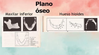 Plano
óseo
Maxilar inFerior Hueso hioides
 