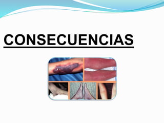 CONSECUENCIAS
 