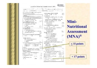 MiniNutritional
Assessment
(MNA)?
< 11 points

< 17 points

 