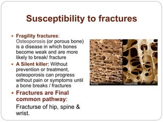 Common Musculoskeletal (orthopedic) disorders in elderly | PPTX