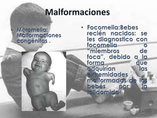 Malformaciones

 