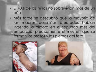 • El 40% de los niños no sobrevivían más de un
año
• Más tarde se descubrió que la mayoría de
las madres de niños afectados habían
ingerido la píldora en el segundo mes del
embarazo, precisamente el mes en que se
forman los brazos y las piernas del feto.

 