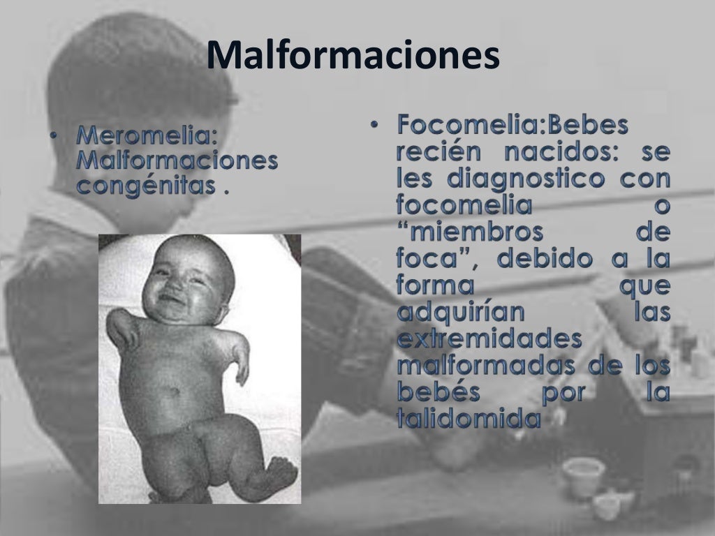 EL DESASTRE DE LA TALIDOMIDA