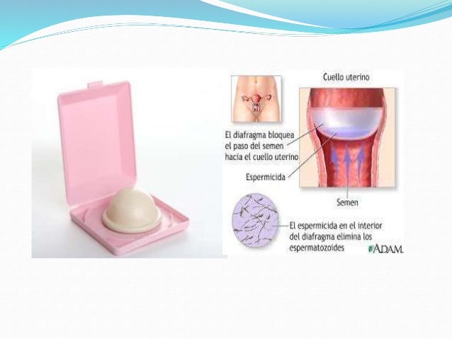 Resultado de imagen para como se debe cuidar el diafragma el diafragma metodo anticonceptivo