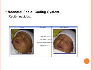   Neonatal Facial Coding System.
    Recién nacidos.
 