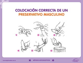 COLOCACIÓN CORRECTA DE UN
                         PRESERVATIVO MASCULINO




                        1)              2)                        3)




                             4)   5)                         6)



www.elegirhacebien.com.ar          MÉTODOS ANTICONCEPTIVOS
 