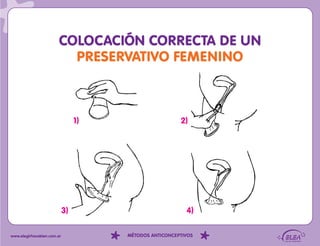 COLOCACIÓN CORRECTA DE UN
                          PRESERVATIVO FEMENINO



                                 1)                     2)




                            3)                            4)

www.elegirhacebien.com.ar             MÉTODOS ANTICONCEPTIVOS
 