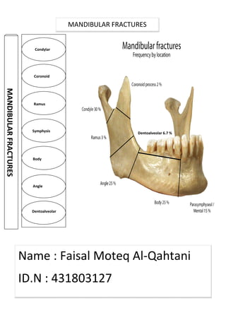 MANDIBULARFRACTURES
Condylar
Coronoid
Ramus
Symphysis
Body
Angle
Dentoalveolar
MANDIBULAR FRACTURES
Name : Faisal Moteq Al-Qahtani
ID.N : 431803127
Dentoalveolar 6.7 %
 