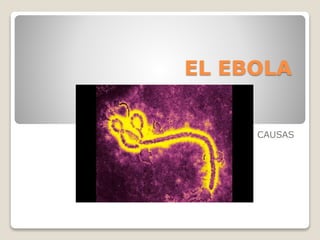 EL EBOLA
CAUSAS
 